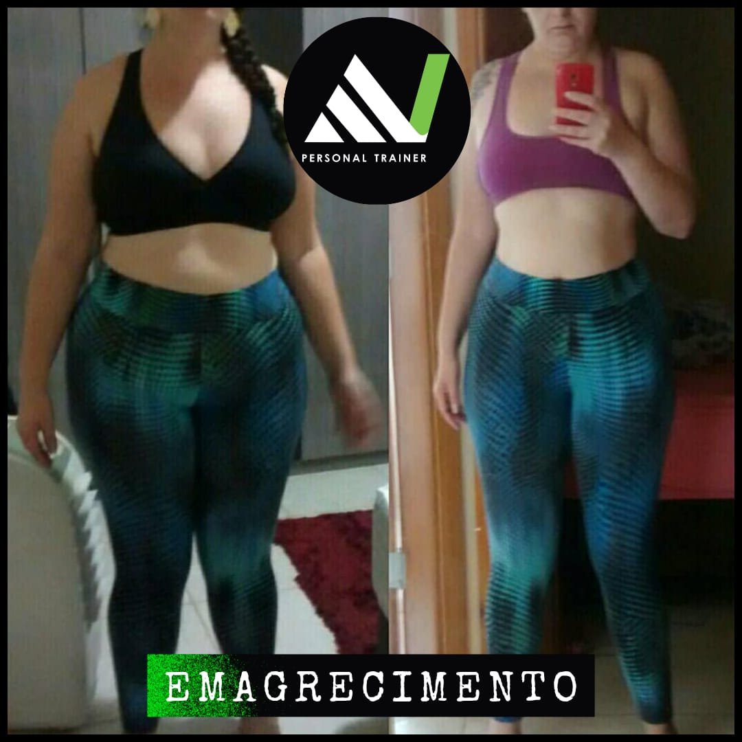 Antes e depois — emagrecimento