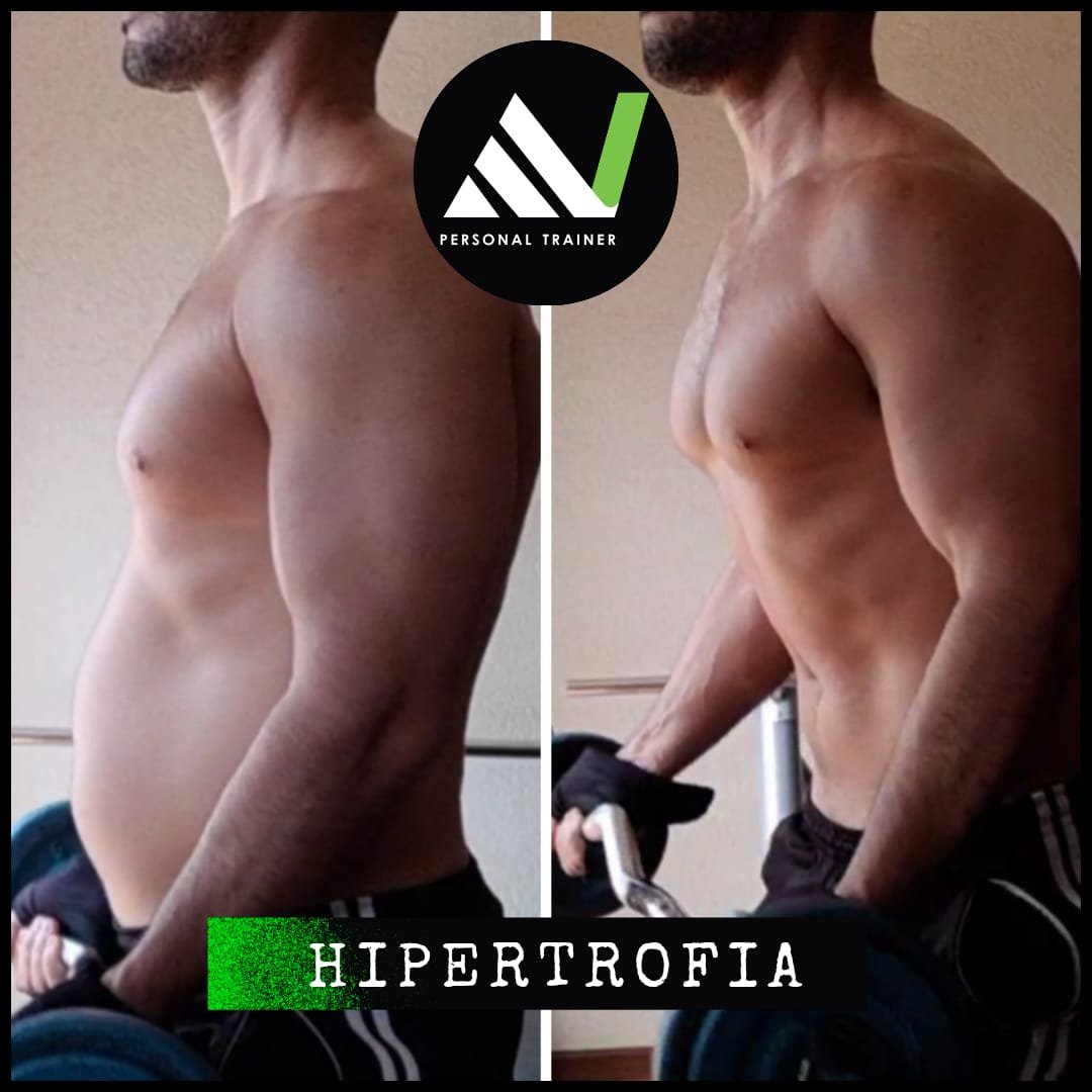 Antes e depois — hipertrofia