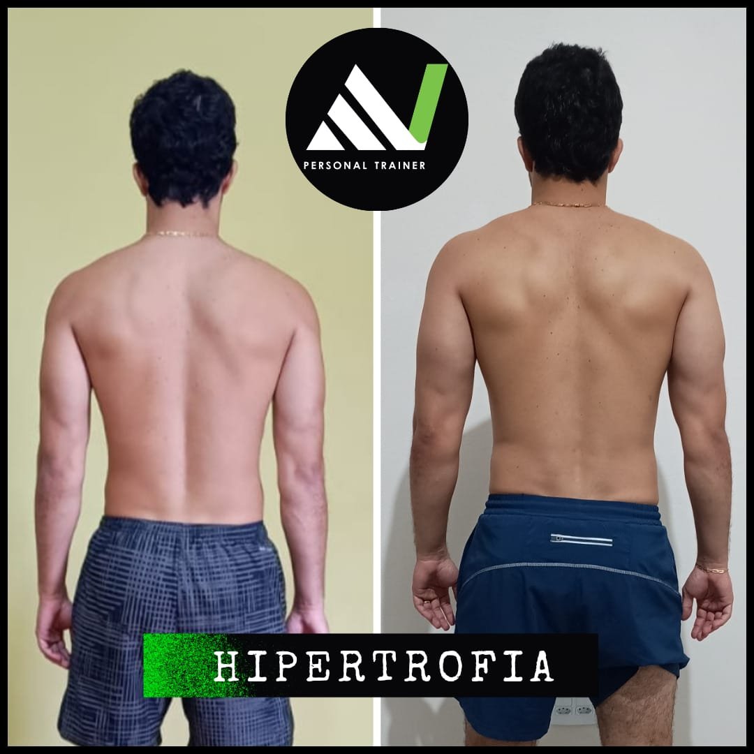 Antes e depois — hipertrofia costas